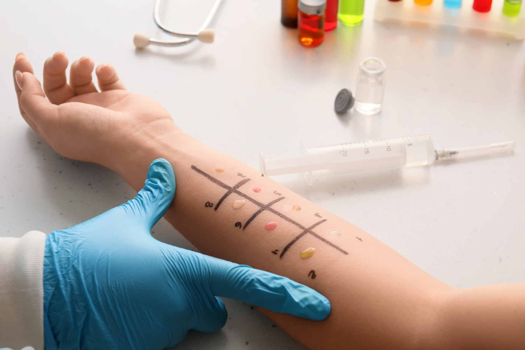 Allergy Test